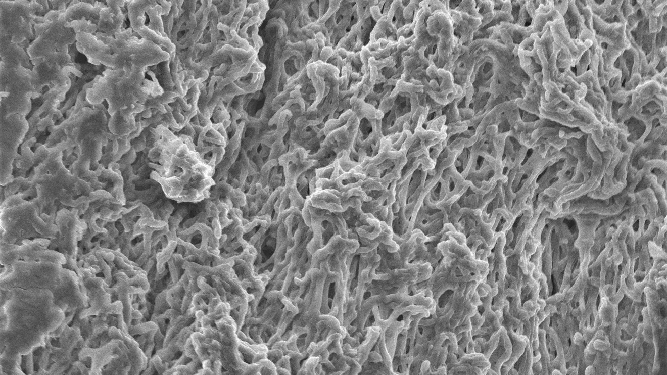 Mycelium-netwerk-(hyphae)---Scanning-electron-microscopy-(SEM)